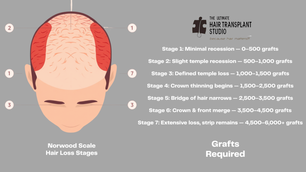 Graft calculation blog